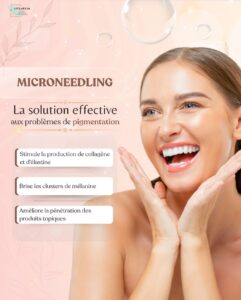 Microneedling à Rabat : Rajeunissement de la peau par micro-aiguilles